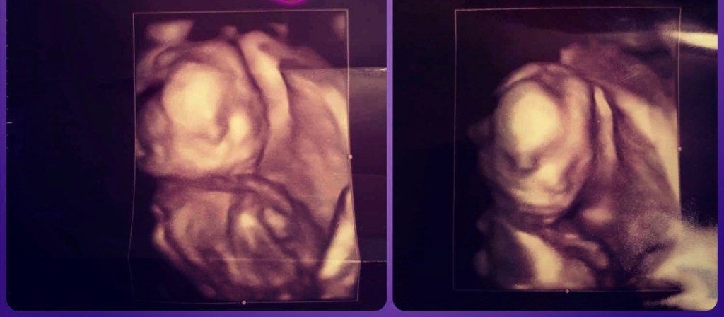 A Letter To My Unborn&nbsp;Child